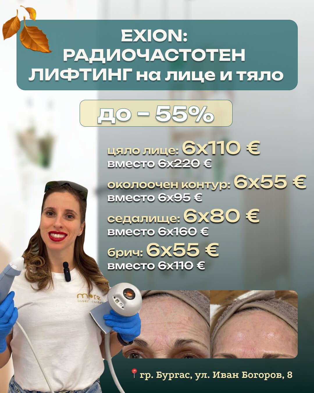EXION радиочестотен лифтинг на лице и тяло в Бургас – промоция до -55% на цяло лице, околоочен контур, седалище и брич